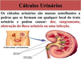 Cálculos Urinários
Os cálculos urinários são massas semelhantes a
pedras que se formam em qualquer local do trato
urinário e podem causar: dor, sangramento,
obstrução do fluxo urinário ou uma infecção.
 