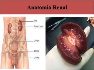 Anatomia Renal
 