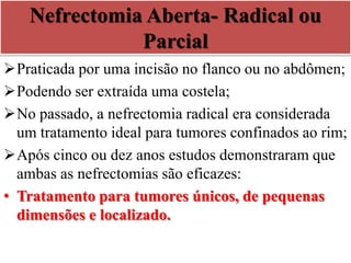 Nefrectomia Aberta- Radical ou
Parcial
Praticada por uma incisão no flanco ou no abdômen;
Podendo ser extraída uma costela;
No passado, a nefrectomia radical era considerada
um tratamento ideal para tumores confinados ao rim;
Após cinco ou dez anos estudos demonstraram que
ambas as nefrectomias são eficazes:
• Tratamento para tumores únicos, de pequenas
dimensões e localizado.
 