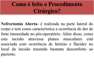 Como é feito o Procedimento
Cirúrgico?
Nefrectomia Aberta- é realizada na parte lateral do
corpo e tem como característica a ocorrência de dor de
forte intensidade no pós-operatório. Além disso, como
esta incisão atravessa planos musculares está
associada com ocorrência de hérnias e flacidez no
local da incisão trazendo bastante desconforto ao
paciente.
 