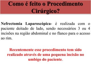 Como é feito o Procedimento
Cirúrgico?
Nefrectomia Laparoscópica- é realizada com o
paciente deitado de lado, sendo necessários 3 ou 4
incisões na região abdominal e no flanco para o acesso
ao rim.
Recentemente esse procedimento tem sido
realizado através de uma pequena incisão no
umbigo do paciente.
 