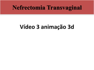 Nefrectomia Transvaginal
Vídeo 3 animação 3d
 