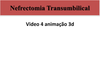 Nefrectomia Transumbilical
Video 4 animação 3d
 