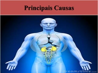 Principais Causas
 