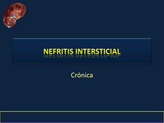 Nefritis Intersticial. Obed Rubio