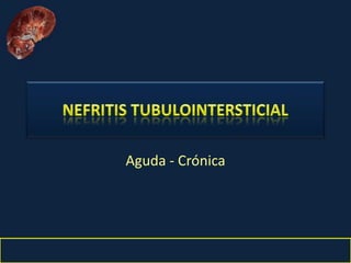 Nefritis Intersticial. Obed Rubio