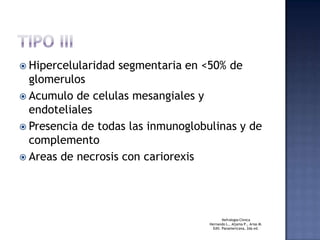 TIPO IIIHipercelularidad segmentaria en <50% de glomerulosAcumulo de celulasmesangiales y endotelialesPresencia de todas las inmunoglobulinas y de complementoAreas de necrosis con cariorexisNefrologiaClinicaHernando L., Aljama P., Arias M.Edit. Panamericana, 2da ed. 