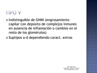 TIPO VIndistinguible de GNMI (engrosamiento capilar con deposito de complejos inmunes en ausencia de inflamación o cambios en el resto de los glomérulos)Suptiposa-ddependiendo caract. extrasNefrologiaClinicaHernando L., Aljama P., Arias M.Edit. Panamericana, 2da ed. 