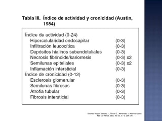 SanchezVegazoSanchez I., Teruel C., Menendez J. Nefritis lupica. REV ESP PATOL 2002; Vol 35, n.º 3: 269-278