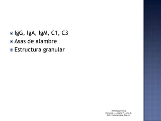 IgG, IgA, IgM, C1, C3Asas de alambreEstructura granularNefrologiaClinicaHernando L., Aljama P., Arias M.Edit. Panamericana, 2da ed. 