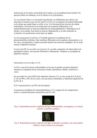 localización en la matriz extracelular de la media y en la membrana basal intimal. No
parecen influir sin embargo, ni en la clínica ni en el pronóstico.

La vasculopatía lúpica es una lesión necrotizante, no inflamatoria que afecta a las
arteriolas en muchos casos de NL tipo IV (15,16). Es un depósito de material fibrinoide
en la íntima que puede llegar a ocluir su luz. Con frecuencia hay necrosis de células
endoteliales y de miocitos en la media pero sin respuesta inflamatoria. Con
inmunofluorescencia se observan depósitos de inmunoglobulinas y fibrinógeno en la
íntima y en la media. Esta lesión se asocia a hipertensión y en estos enfermos la
evolución a la insuficiencia renal suele ser rápida.

La microangiopatía trombótica (17) puede aparecer en cualquiera de las
glomerulonefritis referidas. Hay trombosis fibrinoide en los capilares glomerulares y en
los vasos, mesangiolisis y edema mucoide intimal con eritrocitos atrapados. No se suele
asociar a depósitos inmunes.

Es rara en la NL la vasculitis necrotizante. Es, en todo, semejante a la observada en la
panangeítis nodosa, con necrosis fibrinoide e inflamación. Tampoco se acompaña de
depósitos inmunes.



Inmunofluorescencia (figs. 8 y 9)

La NL es una de las pocas enfermedades en las que se pueden encontrar depósitos
inmunes en cualquiera de las estructuras renales: glomérulos, túbulos, intersticio y
vasos.

En casi todos los casos (98%) hay depósitos intensos (2,5, en una escala de 0-3) de Ig
G. En un 90% y 82% de los casos, con una menor intensidad, se identifican depósitos de
Ig M e Ig A.

El C3 está presente en un 98% de las biopsias.

La presencia simultánea de inmunoglobulinas y C3, o alguno de sus componentes
activos, es particularmente característico de NL (18).




Fig. 8. Inmunofluorescencia: depósitos de IgA subendoteliales, mesangiales y en menor
                             cuantía, en paredes capilares.




Fig. 9. Inmunofluorescencia: depósitos de IgG, en paredes vasculares, con cierto patrón
                       lobular y menos intensos en mesangio.
 