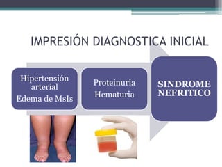 IMPRESIÓN DIAGNOSTICA INICIAL 
Hipertensión 
arterial 
Edema de MsIs 
Proteinuria 
Hematuria 
SINDROME 
NEFRITICO 
 