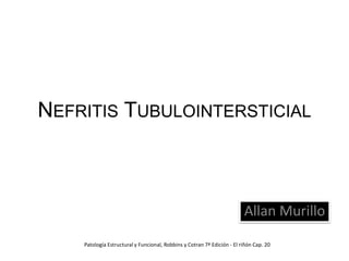 Nefritis Tubulointersticial Allan Murillo Patología Estructural y Funcional, Robbins y Cotran 7ª Edición - El riñón Cap. 20  
