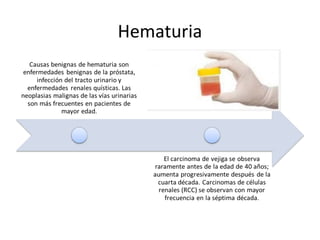 Hematuria
 