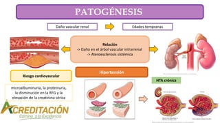 PATOGÉNESIS
Daño vascular renal Edades tempranas
Relación
-> Daño en el árbol vascular intrarrenal
-> Ateroesclerosis sistémica
Riesgo cardiovascular
microalbuminuria, la proteinuria,
la disminución en la RFG y la
elevación de la creatinina sérica
Hipertensión
HTA crónica
 