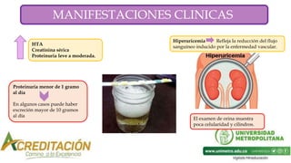 MANIFESTACIONES CLINICAS
HTA
Creatinina sérica
Proteinuria leve a moderada.
Proteinuria menor de 1 gramo
al día
En algunos casos puede haber
excreción mayor de 10 gramos
al día
Hiperuricemia Refleja la reducción del flujo
sanguíneo inducido por la enfermedad vascular.
El examen de orina muestra
poca celularidad y cilindros.
 