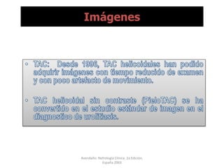 Imágenes
Avendaño. Nefrología Clínica. 2a Edición,
España 2003
 