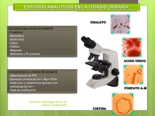 Nefrolitiasis | PPTX