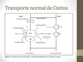 Transporte normal de Cistina

Na

glutatióncisteína
transhidrogenasa

 