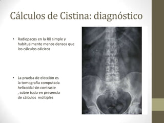 Cálculos de Cistina: diagnóstico
• Radiopacos en la RX simple y
habitualmente menos densos que
los cálculos cálcicos

• La prueba de elección es
la tomografía computada
helicoidal sin contraste
, sobre todo en presencia
de cálculos múltiples

 