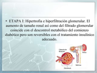  ETAPA I: Hipertrofia e hiperfiltración glomerular. El
aumento de tamaño renal así como del filtrado glomerular
coincide con el descontrol metabólico del comienzo
diabético pero son reversibles con el tratamiento insulínico
adecuado.
 