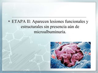  ETAPA II: Aparecen lesiones funcionales y
estructurales sin presencia aún de
microalbuminuria.
 
