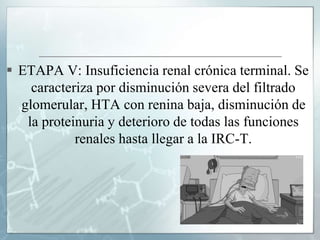  ETAPA V: Insuficiencia renal crónica terminal. Se
caracteriza por disminución severa del filtrado
glomerular, HTA con renina baja, disminución de
la proteinuria y deterioro de todas las funciones
renales hasta llegar a la IRC-T.
 
