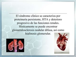 El síndrome clínico se caracteriza por
proteinuria persistente, HTA y deterioro
progresivo de las funciones renales.
Hísticamente se puede encontrar
glomerulosclerosis nodular difusa, así como
hialinosis glomerular.
 