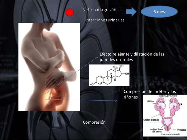 La hernia intervertebral dedushkin el secreto