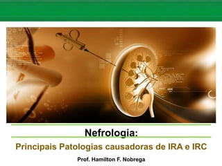 Nefrologia:
Principais Patologias causadoras de IRA e IRC
Prof. Hamilton F. Nobrega
 