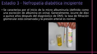 • Se caracteriza por el inicio de la micro albuminuria (definida como
una excreción de albúmina en orina). Generalmente, ocurre de diez
a quince años después del diagnóstico de DM1; la tasa de filtración
glomerular está conservada y la presión arterial es normal.
 