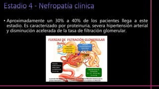 • Aproximadamente un 30% a 40% de los pacientes llega a este
estadio. Es caracterizado por proteinuria, severa hipertensión arterial
y disminución acelerada de la tasa de filtración glomerular.
 