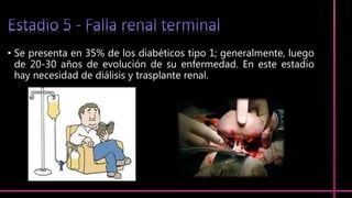 • Se presenta en 35% de los diabéticos tipo 1; generalmente, luego
de 20-30 años de evolución de su enfermedad. En este estadio
hay necesidad de diálisis y trasplante renal.
 