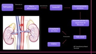 Macro
albuminuria
Existe IRT
Funcionamiento
excesivo
Riñones pierden la
capacidad de
filtración
Fallo renal
Trasplante
de riñón
Diálisis
Nefropatía
Detectada en:
Generalmente:
Provocando
IRT: Insuficiencia Renal
Terminal
 