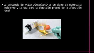 • La presencia de micro albuminuria es un signo de nefropatía
incipiente y se usa para la detección precoz de la afectación
renal.
 