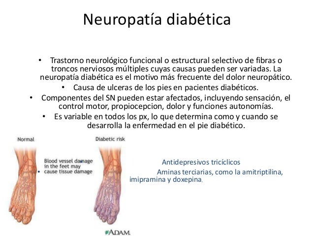 Nefropatia Diabetica Nefropatia Diabetica