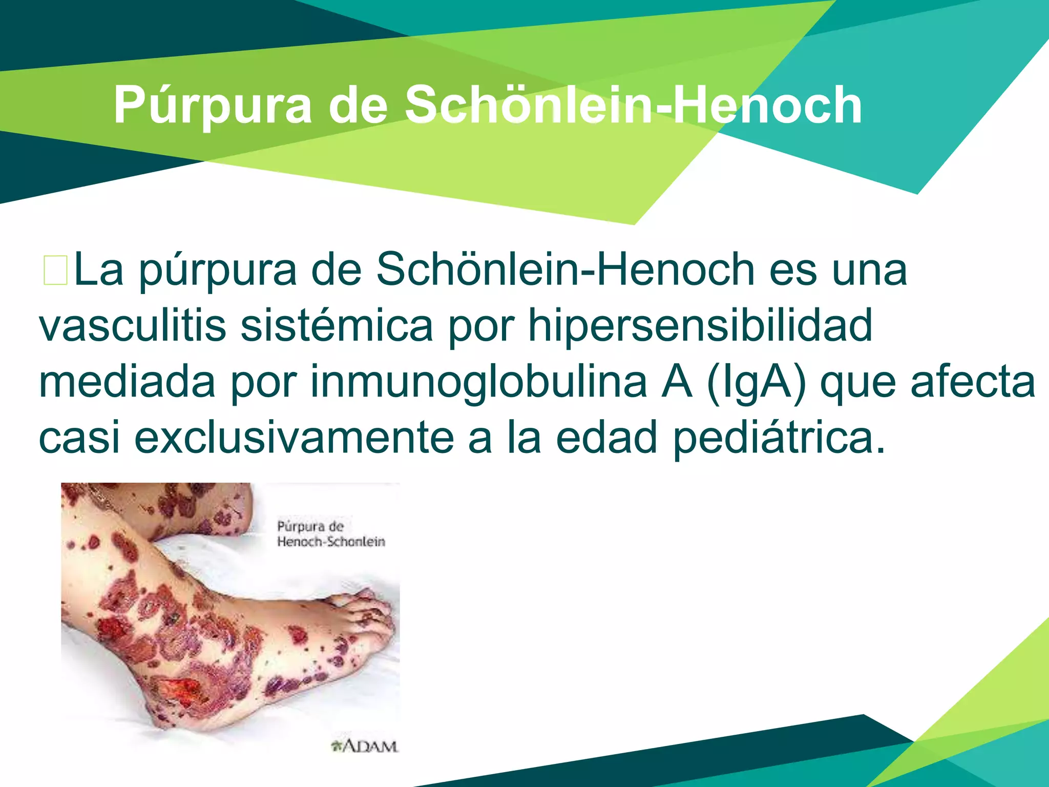 nefropat-a-en-la-p-rpura-de-sch-nlein-henoch-ppt