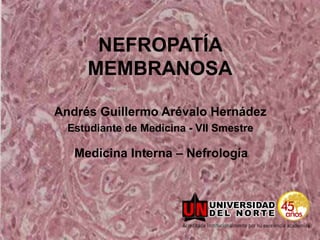 NEFROPATÍA
     MEMBRANOSA

Andrés Guillermo Arévalo Hernádez
  Estudiante de Medicina - VII Smestre

   Medicina Interna – Nefrología
 