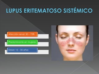 Afección renal: 50 – 75%


Predominante en mujeres


Edad: 15 – 35 años
 