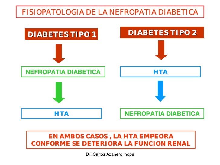 Nefropatia Diabetica