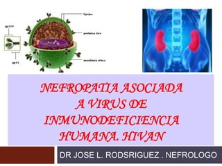 NEFROPATIA ASOCIADA
A VIRUS DE
INMUNODEFICIENCIA
HUMANA. HIVAN
DR JOSE L. RODSRIGUEZ . NEFROLOGO
 