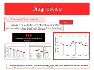 Diagnóstico
Ecuaciones de filtrado glomerular
1. Nambirajan Sundaram, Michael Bennett, Jamie Wilhelm, Mi-Ok Kim, George Atweh, Prasad Devarajan, and Punam Malik. Biomarkers
for early detection of sickle nephropathy. Am. J. Hematol. 86:559–566, 2011
2011
116
Pacientes con anemia de células
falciformes
 