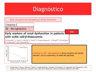 Diagnóstico
1. E Voskaridou, E Terpos, S Michail, E Hantzi, A Anagnostopoulos, A Margeli, D Simirloglou, D Loukopoulos and I Papassotirio. Early
markers of renal dysfunction in patients with sickle cell/b-thalassemia. Kidney International (2006) 69, 2037–2042
Otros marcadores de nefropatía por células falciformes
Cistatina C
β2 - Microglobulina
2006
Cistatina C y β2 – Microglobulina sérica muestra una fuerte
relación con la creatinina y la edad del paciente.
 
