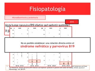 Fisiopatología
1. Lynn Quek, Claire Sharpe, Neelanjana Dutt, Sue Height, Marlene Allman, Moji Awogbade,1David C Rees, Mark Zuckerman and Swee
Lay TheinAcute. Human parvovirus B19 infection and nephrotic syndrome in patients with sickle cell disease. British Journal of
Haematology, 149, 289–291
Acute human parvovirusB19 infection and nephroticsyndrome
in patients with sickle cell disease
LynnQuek,1
ClaireSharpe,2,3
Neelanjana
Dutt,4
SueHeight,1
MarleneAllman,1
Moji Awogbade,1
David CRees,1,3
Mark
Zuckerman5
and SweeLay Thein1,3
1
Department of Haematological Medicine,
2
Department of Renal Medicine, 3
King’sCollege
LondonSchool of Medicine, Division of Geneand
Cell BasedTherapy, 4
Department of
Summary
AcuteHuman Parvovirus B19 (HPV B19) infection isthemajor cause of
transient red cell aplasia(TRCA) and acuteanaemiain patientswith sickle
celldisease(SCD).Wereport threecasesofpatientswhodevelopednephrotic
syndrome (NS) with chronic sequelae after initially presenting with HPV
B19-associated TRCA. Therewasno correlation between evidenceof HPV
short report
2010
et al, 1993, 2001; Smith-Whitley et al, 2004) and is a major
cause of transient red cell aplasia (TRCA) (Goldstein et al,
1987). It has also been previously suggested as a trigger of
nephrotic syndrome (NS) in patients with SCD (Wierenga
et al, 1995). The possible association between acute HPV B19
infection and NS was investigated in our cohort of SCD
patients. Information was gathered on (i) 37 individuals with
SCD of all ages admitted to King’s College Hospital (KCH)
with acute HPV B19 infection between November 2002 and
July 2008 and (ii) baseline HPV B19 status and indices of
proteinuria and renal function in a cohort of 317 adult SCD
patientswho attended thespecialist clinic between January and
December 2008.
The diagnosis of acute parvovirus B19 infection in aplastic
crisis was based on positive HPVB19 IgM, with or without
positive IgG, and past exposure to parvovirus infection based
on positive HPV B19 IgG. HPV B19 IgM and IgG antibodies
were detected by using antibody sandwich enzyme immuno-
to below steady-statelevelsof morethan 30 g/l associated wit
a very low reticulocyte count.
Of the37individuals(median age8 years; range2–27 years
with acuteHPV B19 infection presenting with acutecrisisan
TRCA, 29 were children below the age of 16 years, and eigh
were patients over the age of 16 years. Thirty-two (25 below
16 yearsold and 7over age16 years) of the37patientshad th
HbSS genotype, two HbSC and three HbSb thalassaemi
genotypes. Three patients developed NS within 4 months o
acuteHPV B19 infection and TRCA; Patient 1 at 17, Patient
at 26, and Patient 3 at 11 years of age at diagnosis.
Patient 1 had stable HbSC disease with a steady-stat
haemoglobin level of 130–140 g/l and serum creatinine leve
of between 70 and 80 l mol/l. In May 2004 he was admitte
with acute pain and dyspnoea. Investigations conﬁrmed a
aplastic crisiswith ahaemoglobin level of 75 g/l and avery low
reticulocyte count of 5Æ3 · 1012
per litre (normal 50
150 · 1012
per litre) associated with an acute parvoviru
First published online 7 January 201
ª 2010 Blackwell Publishing Ltd, British Journal of Haematology, 149, 289–291 doi:10.1111/j.1365-2141.2009.08062.
Microalbuminuria y proteinuria
No es posible establecer una relación directa entre el
síndrome nefrótico y parvovirus B19
 