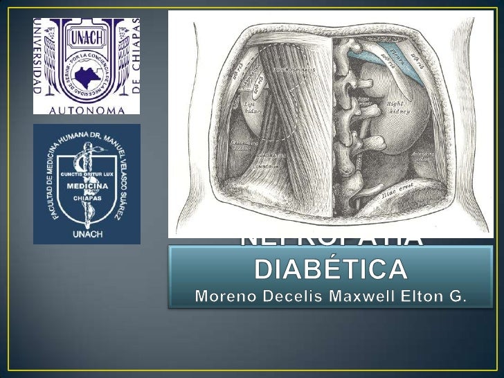 Nefropatía Diabética. Nefropatía Diabética.