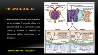  Disminución de la actividad funcional
de la proteína C activada afecta a la
permeabilidad de la glomerular pared
capilar...