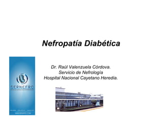 Nefropatía Diabética

   Dr. Raúl Valenzuela Córdova.
       Servicio de Nefrología
Hospital Nacional Cayetano Heredia.
 