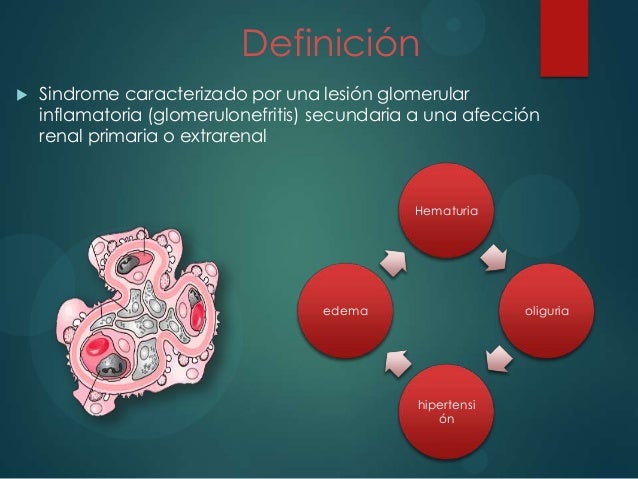 sindrome nefritico en pediatría 2014 sindrome nefritico en pediatría 2014