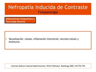 Nefropatia Inducida Por Medio De Contraste 2015 PPTX