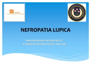 NEFROPATIA LUPICA
MARLON ADRIAN LAGUADO NIETO.
R1 MEDICINA INTERNA FUCS/H. SAN JOSE
 